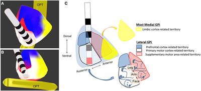 Therapeutic Perspective on Tardive Syndrome with Special Reference to Deep Brain Stimulation